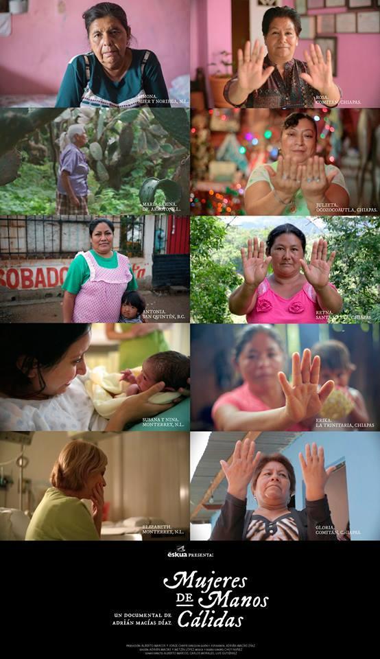 Mujeres de manos cálidas