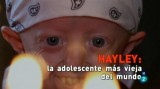 Hayley, la adolescente más vieja del mundo (TV)