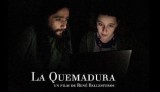 La quemadura