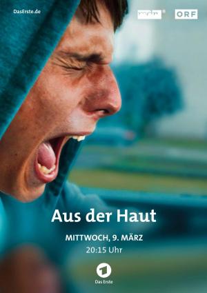 Aus der Haut (Shed My Skin) (TV)