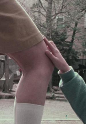 Bizarre disease ?? (C)