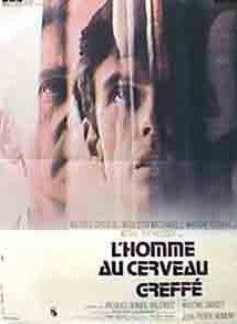 El hombre del cerebro transplantado
