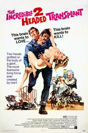 El increíble transplante bicéfalo